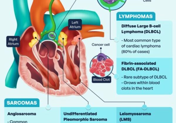 Heart Cancer